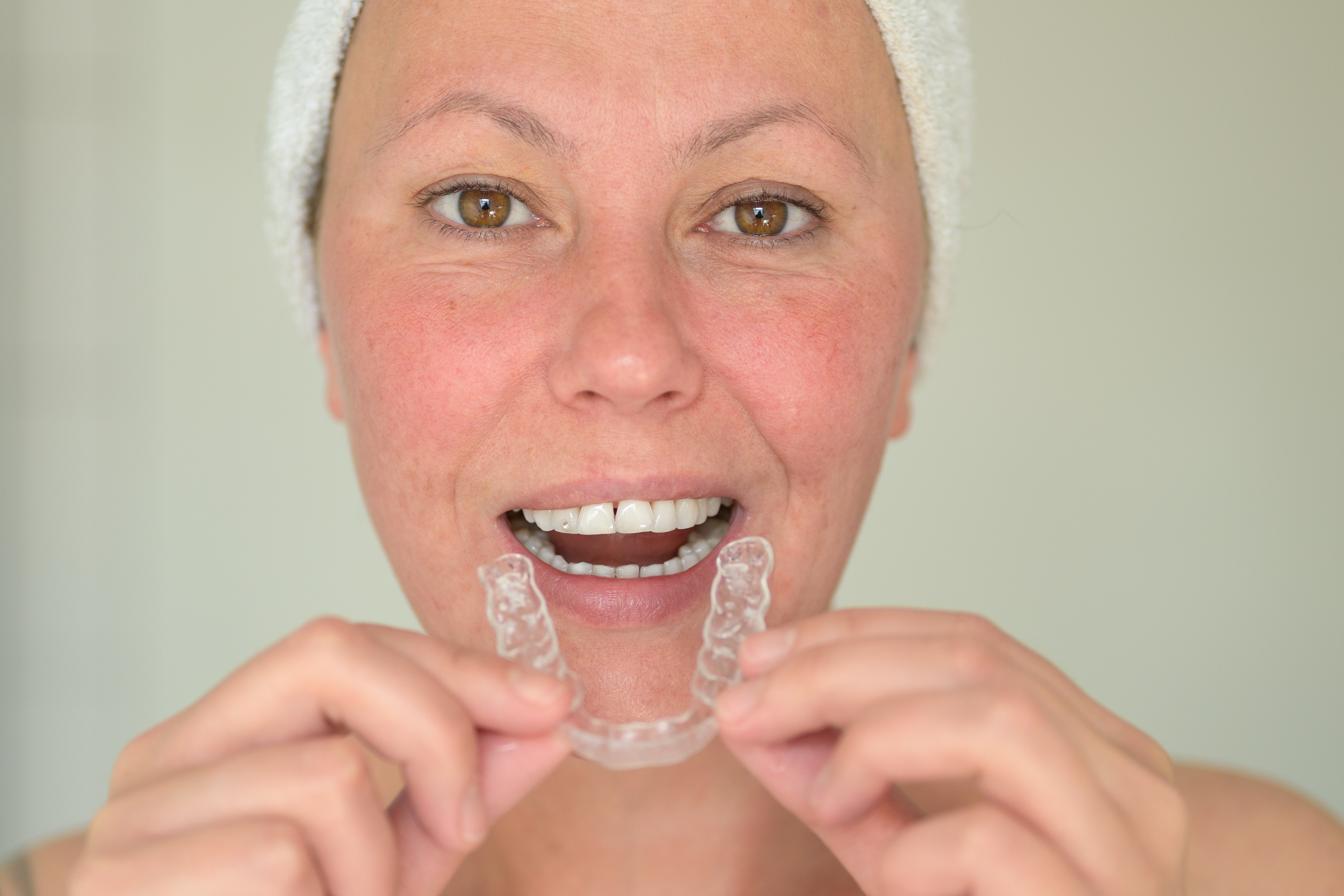 Benefits of CustomMade Night Guards