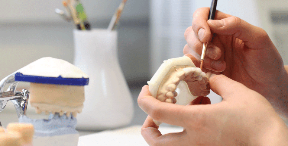 STORE & SAVE PLAN: STORE YOUR TEETH MOLD FOR 5 YEARS AND LOCK IN AT DISCOUNTED PRICING Questions & Answers