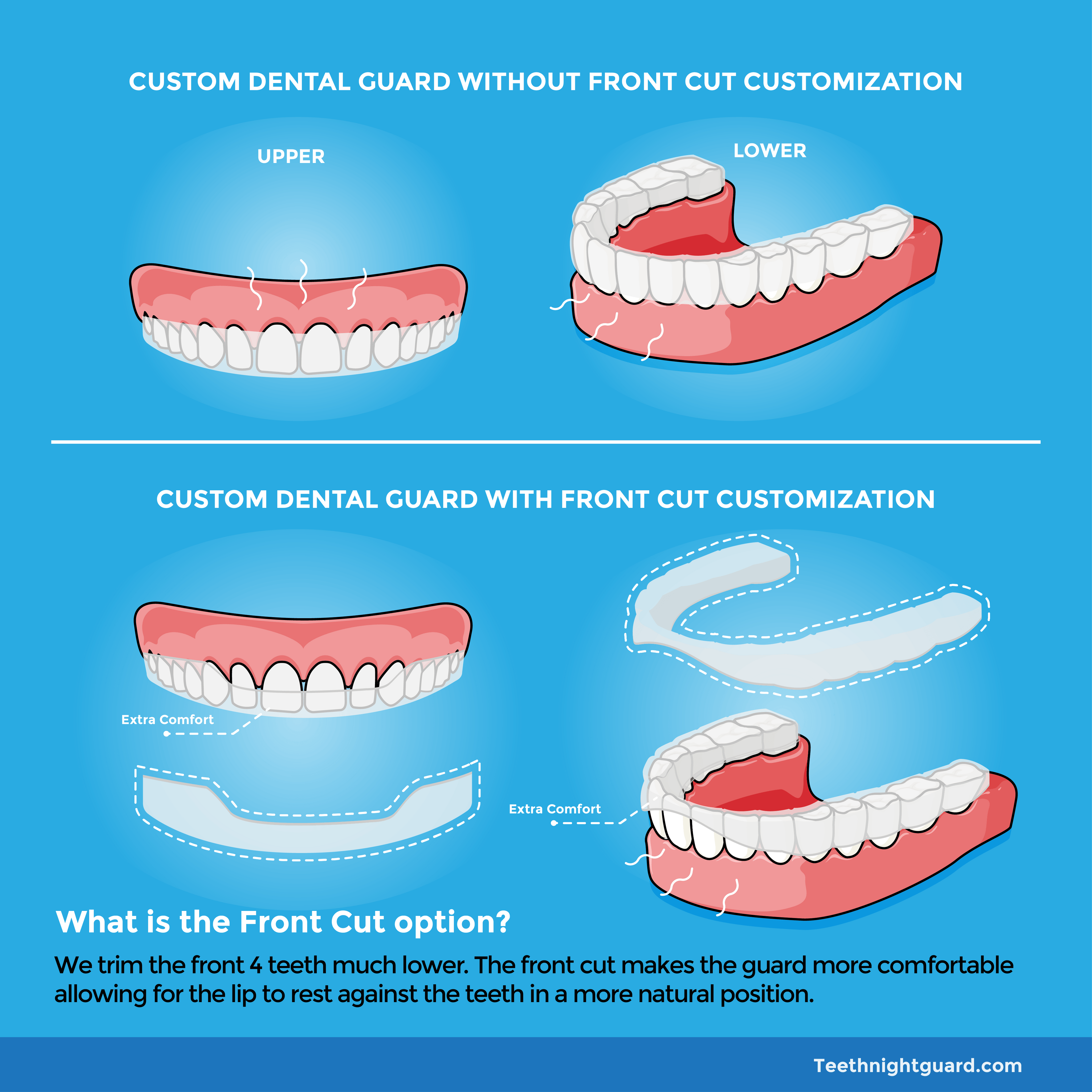 Soft Thin Custom Teeth Night Guard For Teeth Clenching